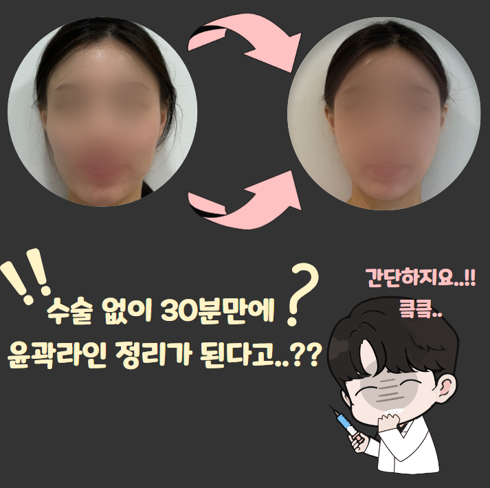 레이저도.. 실도 아니다..?? 콜라겐 볼륨리프팅! 다 알려드림