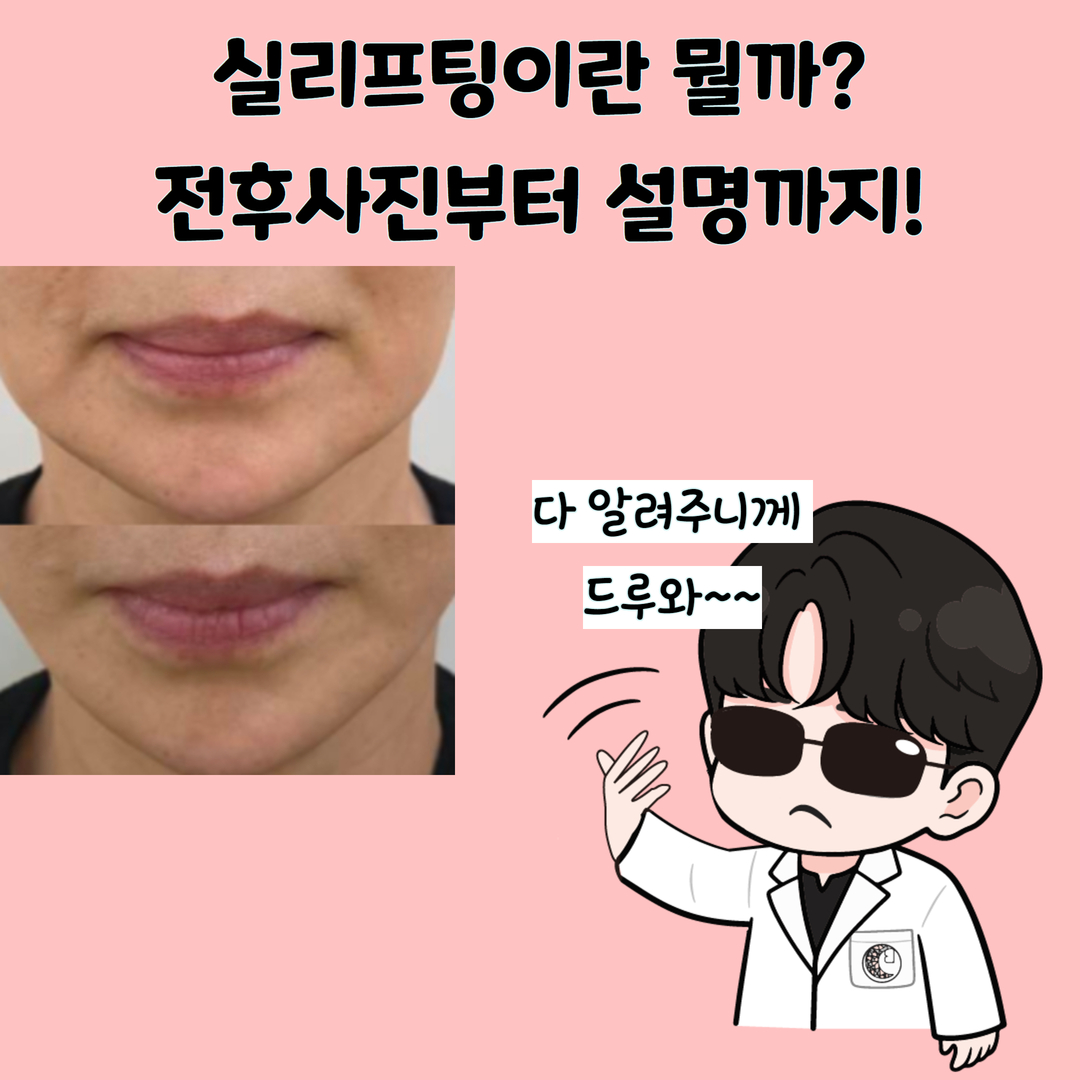 정확하고 빠른 실리프팅 ! 마리오네트 주름부터 무너진 턱라인 등 한 번에 해결!