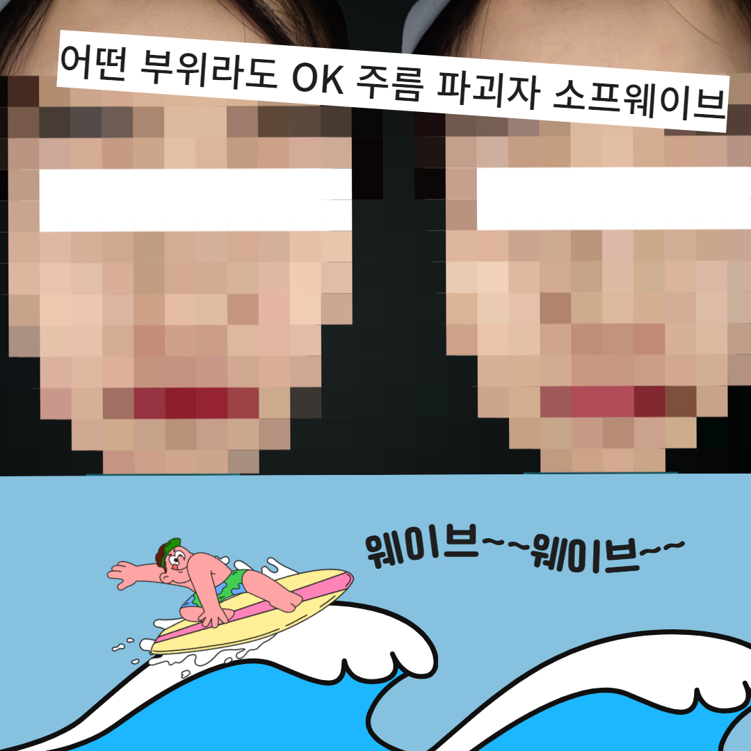내가 해도 친구가 해도! 누가 하던 완전 럭키비키인 소프웨이브! 인천리프팅대가를 꿈꾸는 쌈무원장이 추천하는 리프팅 기계, 소프웨이브!