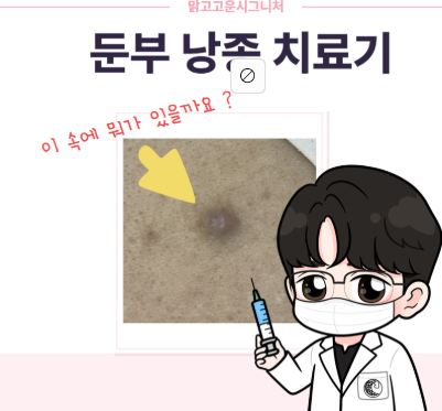 둔부(엉덩이)에 생긴 낭종 ! 꼭 제거해야만 할까..? 제거과정까지 모두! 알아봅시다~